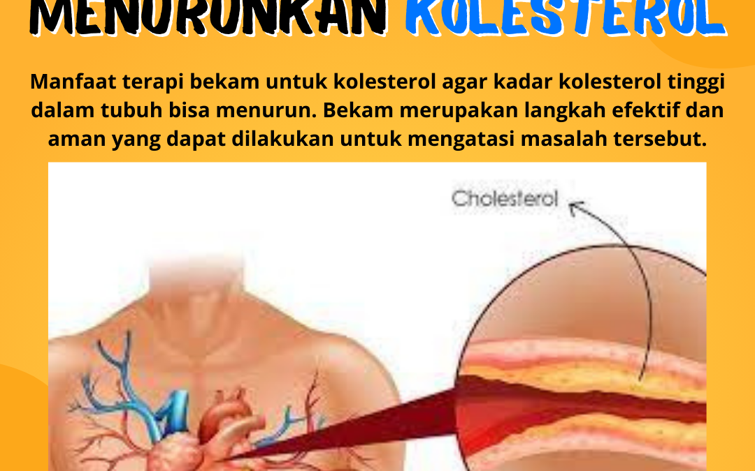 Bekam Dapat Menurunkan Kolesterol?