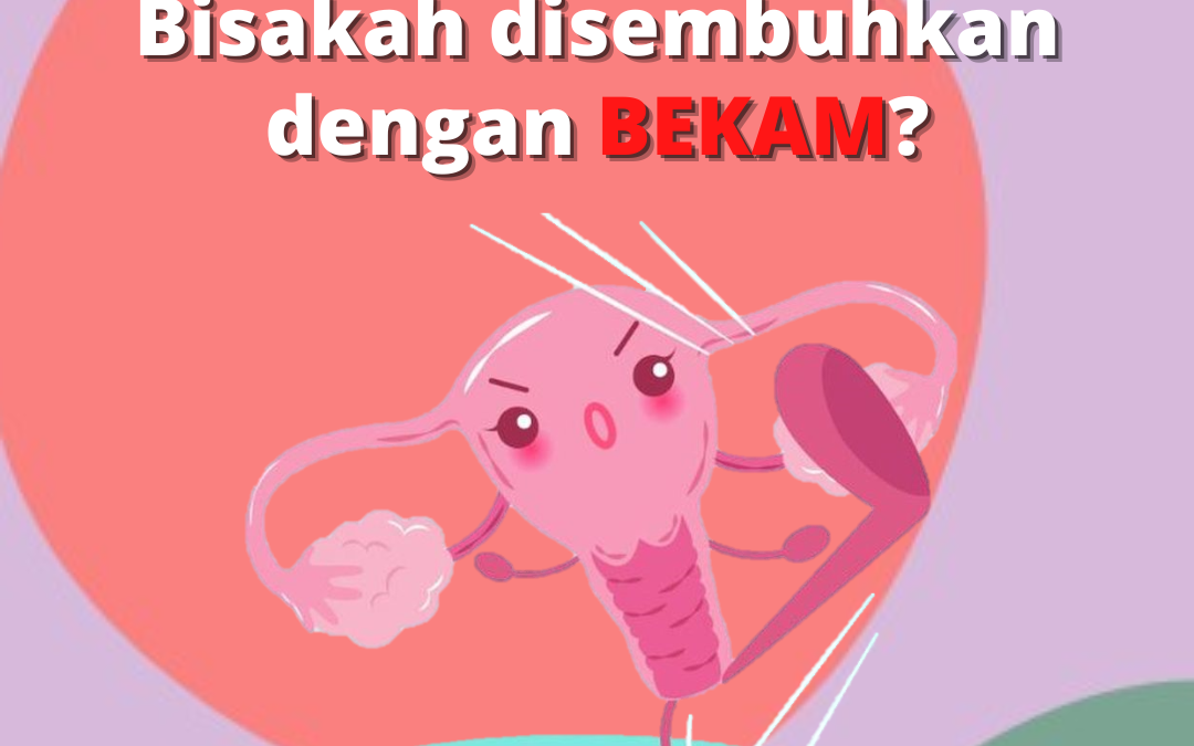 Penyakit Kista Myom Mioma InsyaAllah Sembuh Ikhtiar Dengan Terapi Bekam
