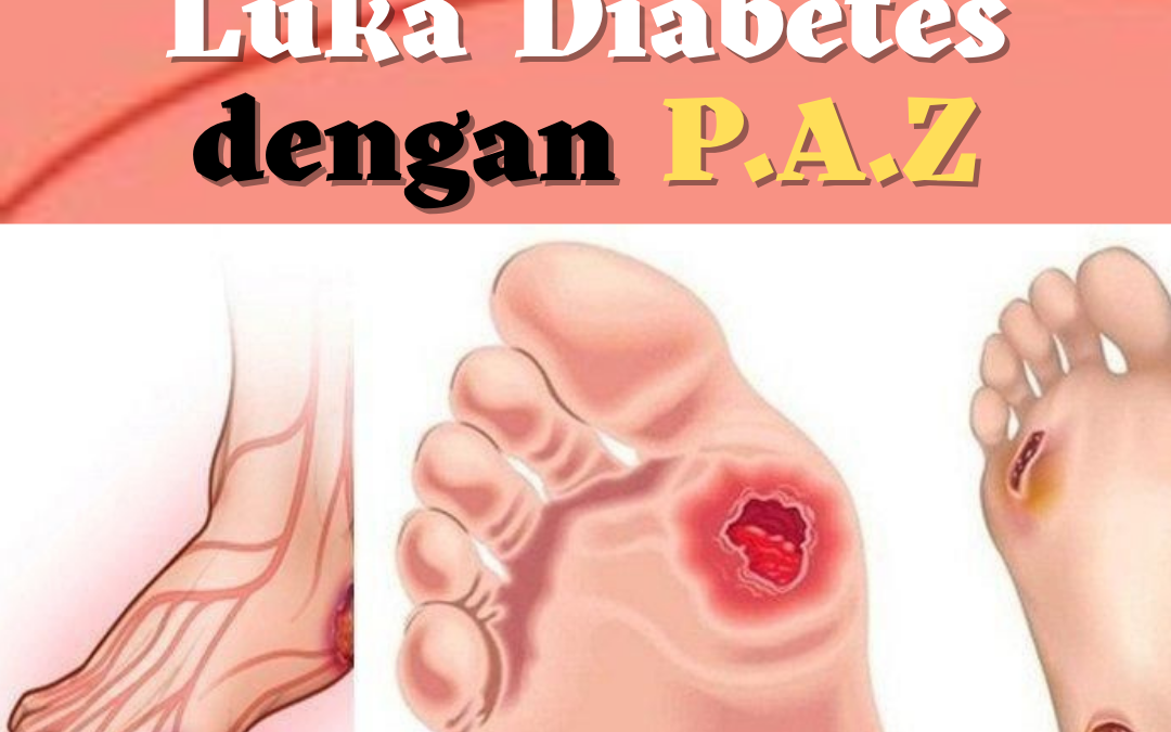 Penyakit Diabets Sembuh Dengan Terapi PAZ