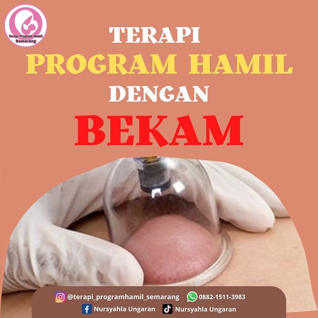Terapi Program Hamil dengan Bekam