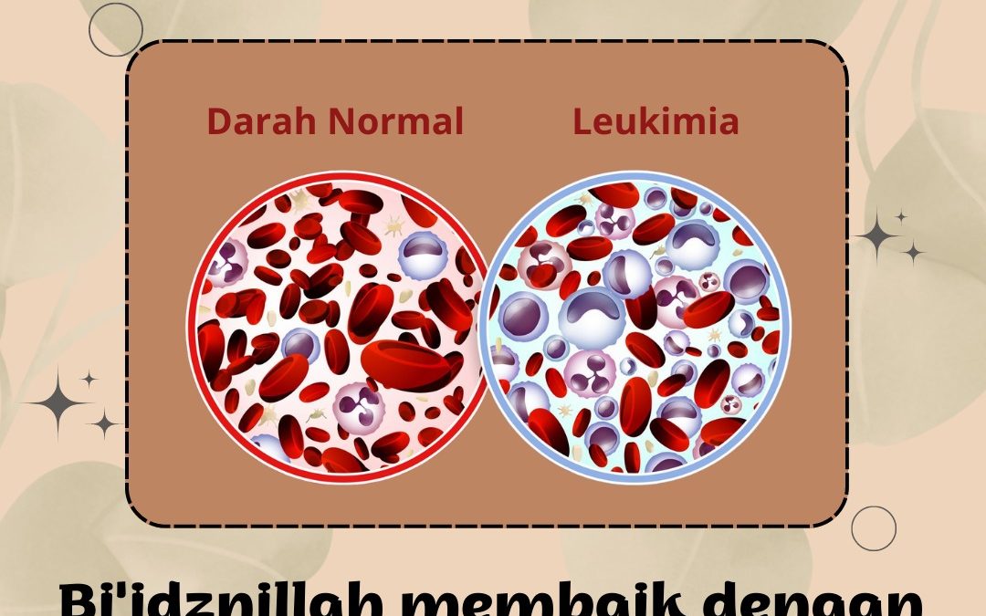 Keluhan Sakit Leukimia Bi’idznillah Membaik dengan Terapi PAZ