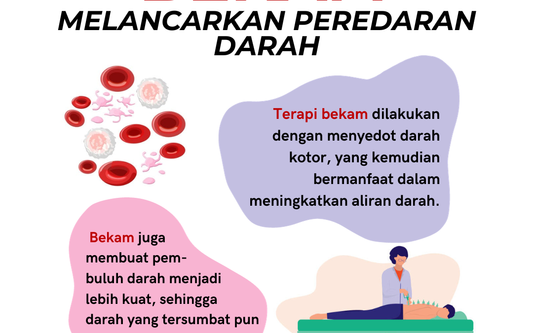 Melancarkan Peredaran Darah, Salah Satu Manfaat Terapi Bekam Bagi Kesehatan