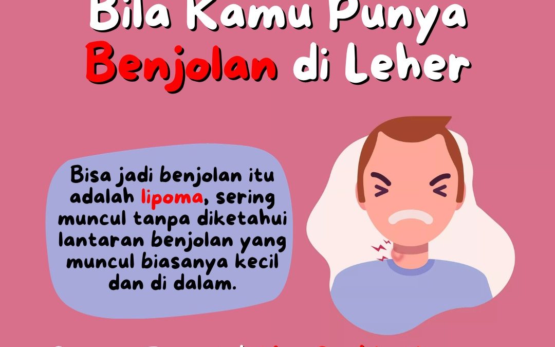DIANGGAP SEPELE, LIPOMA BISA BERAKIBAT FATAL