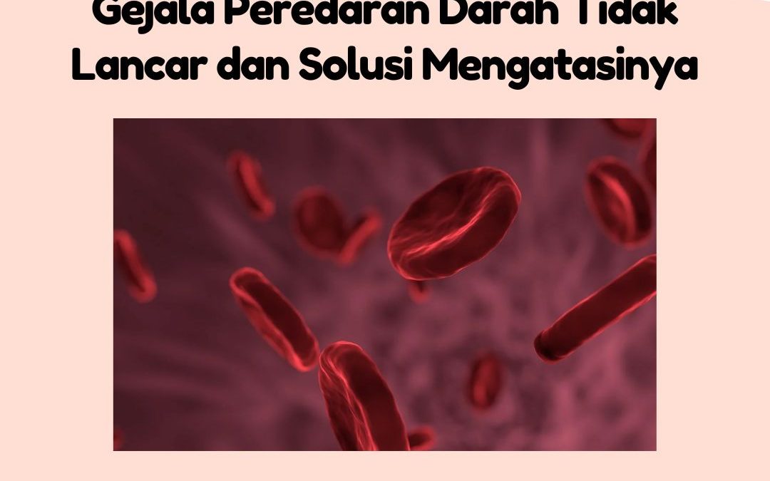 Gejala Peredaran Darah Tidak Lancar dan Solusi Mengatasinya