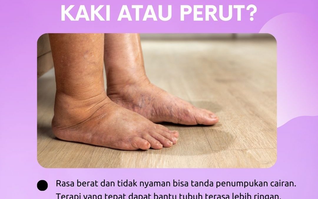 Perut & Kaki Sering Bengkak? Waktunya Tindakan!